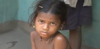 Stunning Malnutrition in Orissa Statistics and Facts